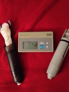 This is my first insulin pump, the MiniMed 506. I got it in 1994. I've been wearing a pump for 20 years.